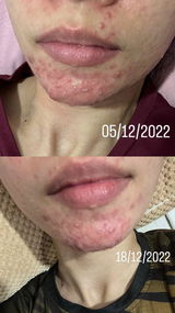 Syuhadah R. review photo