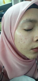 radiatul a. review photo