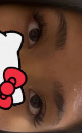 Anonymous review photo