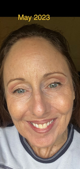 Anonymous review photo