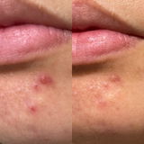 GGLOW Exfoliante - 5% Ácido Glicólico & Niacinamida