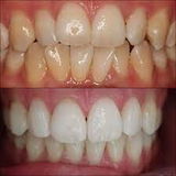 Marni review photo