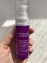 Anonymous review photo