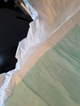 Cauda Equina sufferer review photo