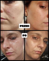 Iwona review photo