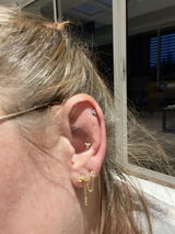 Anonyme review photo
