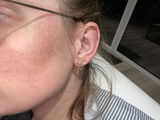 Anonyme review photo