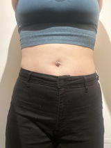 Anonyme review photo