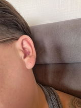 Anonyme review photo