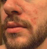 Octaskin Serum