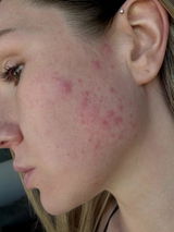Lavinia review photo