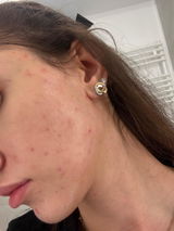 Ioana review photo