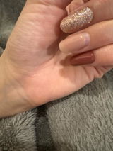 匿名 review photo