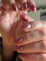 Buse B. review photo
