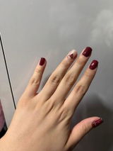 BUSE review photo