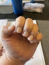 Anonymous review photo