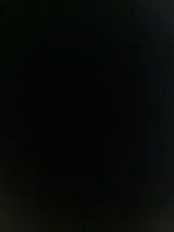 Anonyme review photo