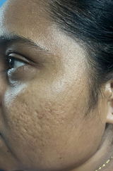 Asha review photo