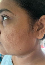 Asha review photo