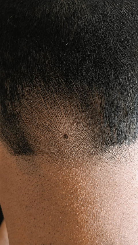 Advanced Ayurvedic Formula for Alopecia Treatment | Doctor Recommended | 100% Safe & Effective