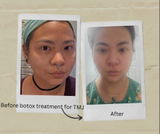 Abby yee (UGC) review photo