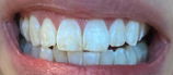 Maryam Noor review photo