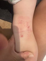 Chelsea Baudoin review photo
