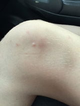 Anonymous review photo