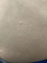 Anonymous review photo