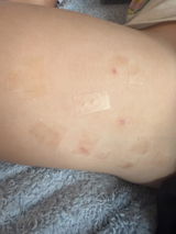 Anonymous review photo