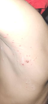 Anonymous review photo
