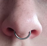 Chlorine review photo
