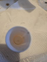 Anonymous review photo