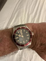 Anonymous review photo
