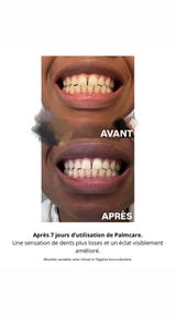 Anonyme review photo