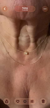 Anonymous review photo