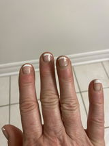 Anonymous review photo