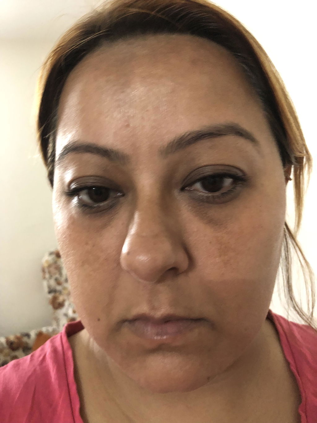 Foto compartida en una opinión