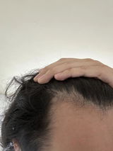 Anonymous review photo