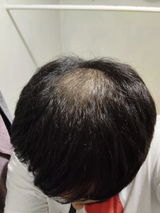 Anonymous review photo