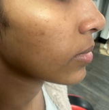 Chandana S review photo