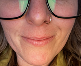 Anonymous review photo