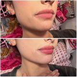 *** review photo