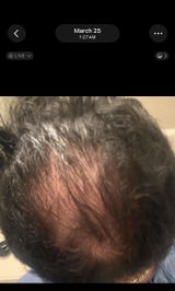 Anonymous review photo