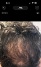 Anonymous review photo