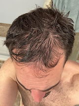 Anonymous review photo
