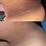 P.p. review photo