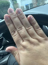 Anonymous review photo