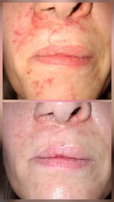 Maeva review photo