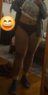 Anonymous review photo